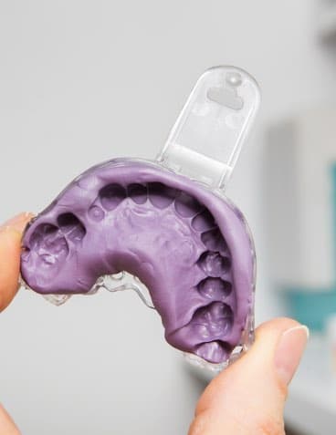 Services - Dentiste Gatineau Dentist - Hull - Clinique dentaire Catherine Morin-Houde